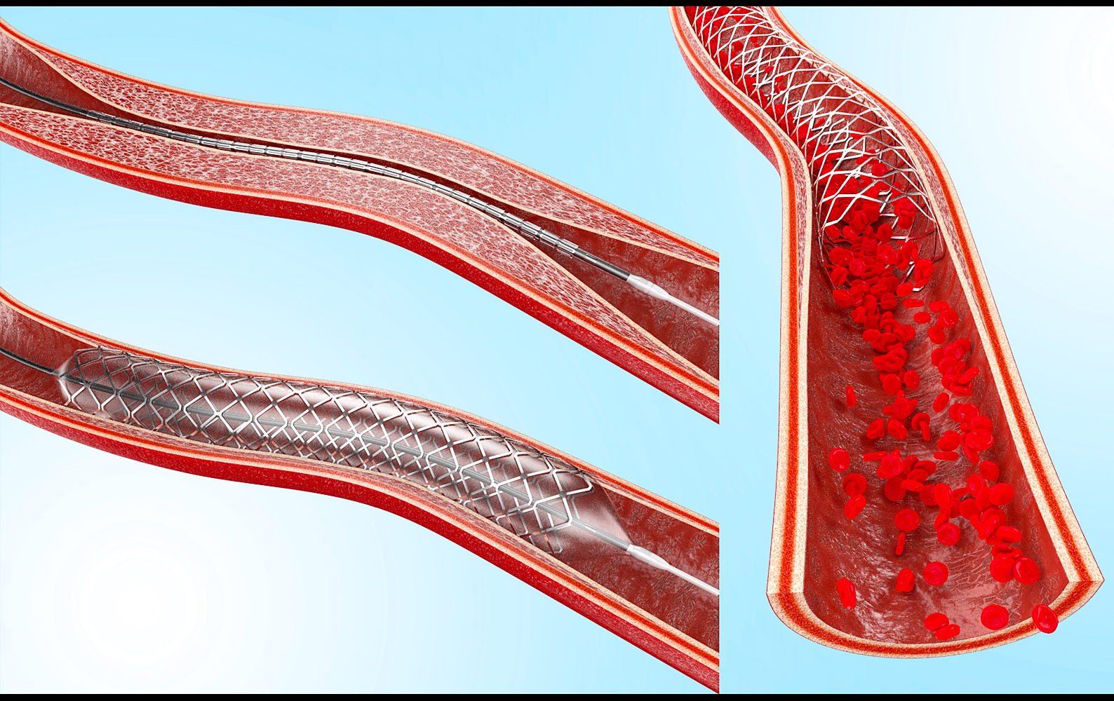 illustration-3D-philippe-raimbault-artere