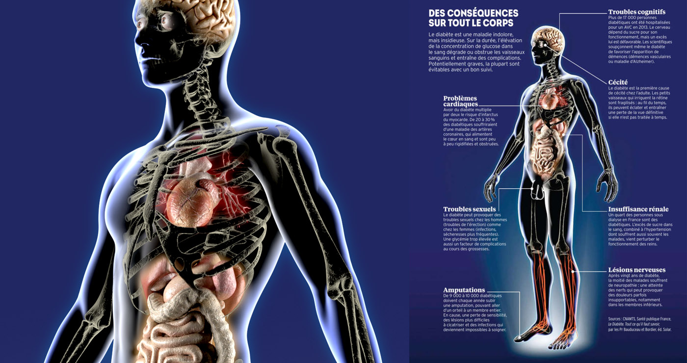 illustration-3D-philippe-raimbault-medical